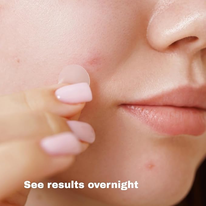 Clear Acne Patches – Pharmacist‑Formulated Hydrocolloid Pimple Stickers with Salicylic Acid & Tea Tree Oil (108 Count, 8 mm & 12 mm) – Invisible, Gentle & Fast‑Acting