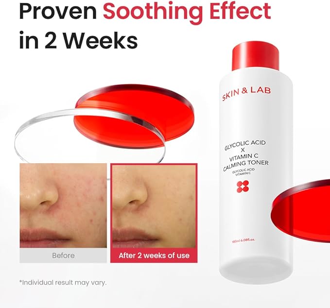 [Skin&LAB] GLYCOLIC Acid X Vitamin C Calming Toner, 6.08 fl. oz.