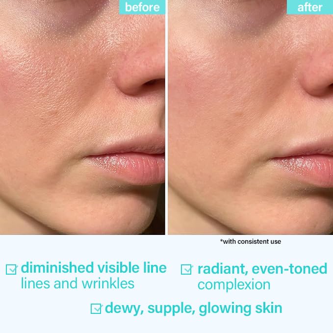 (2Pc) VedoAID Snail Mucin 96% Repair Essence: Advanced Hydrating Serum for Skin Repair, Anti-Aging, and Discoloration Correction (100ml+100ml)