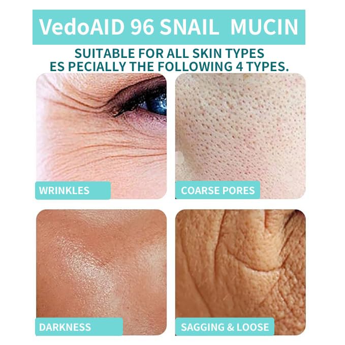(2Pc) VedoAID Snail Mucin 96% Repair Essence: Advanced Hydrating Serum for Skin Repair, Anti-Aging, and Discoloration Correction (100ml+100ml)