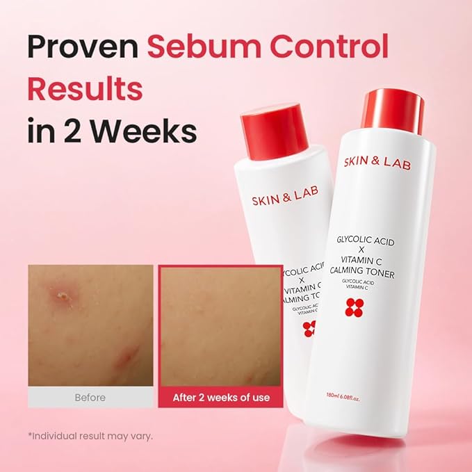 [Skin&LAB] GLYCOLIC Acid X Vitamin C Calming Toner, 6.08 fl. oz.