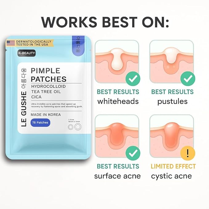 LE GUSHE Korean Pimple Patches for Face (132 Dots) - Hydrocolloid Acne Patches with Tea Tree Oil - Invisible Zit Stickers - Dermatologist Tested - Korean Skin Care