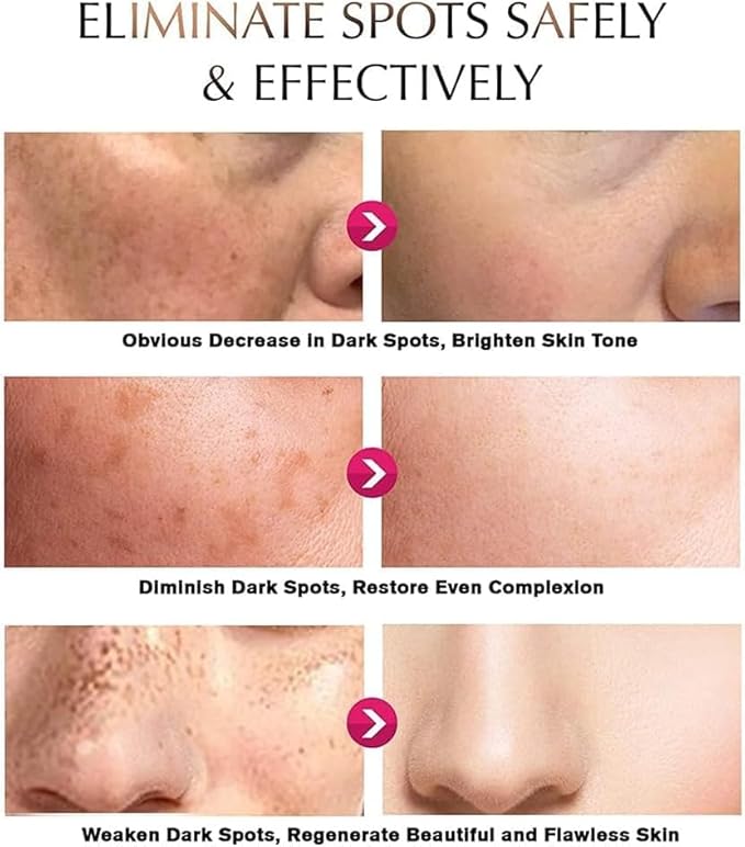 Snow Bleach Cream for for Private Part, Intimate Areas-Underarm, Neck, Armpit, Knees, Elbow Face and Body Skin (3Pcs)