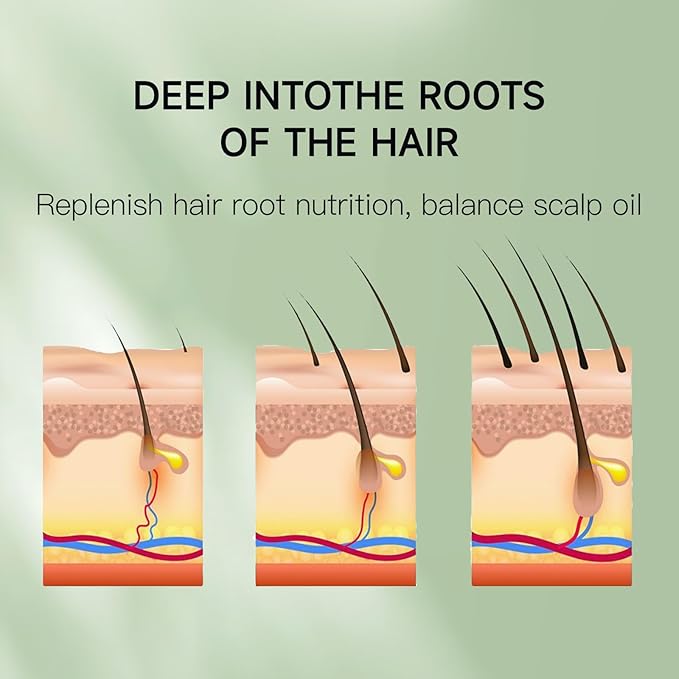 Venrock Rosemary Castor Hair Oil - Biotin Infused Scalp & Hair Strengthening Oil for Nourishing Scalp, Repairing Split Ends & Encouraging Longer, Healthier Hair | Lightweight Daily Hair Care