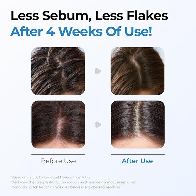 Bubble Tonic | Leave-In Scalp Exfoliator Foam for Oily, Sweaty, or Itchy Roots | Clears Buildup & Sweat with No Residue | Cooling Relief with Menthol & Salicylic Acid | Korean Hair Care Detox