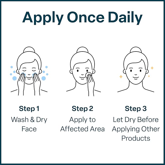 QRxLabs Salicylic & Glycolic Acid Pads (2% Salicylic & 10% Glycolic) - Acne Pads for Face & Bacne with Vitamins B5, C & E, Calendula & Green Tea - Face Exfoliator - 50 Count Jar