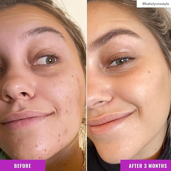 Good Molecules Niacinamide Brightening Toner Pack 2 – 120 ml / 4 fl oz Each | Facial Toner with Niacinamide & Arbutin for Even-Looking Skin