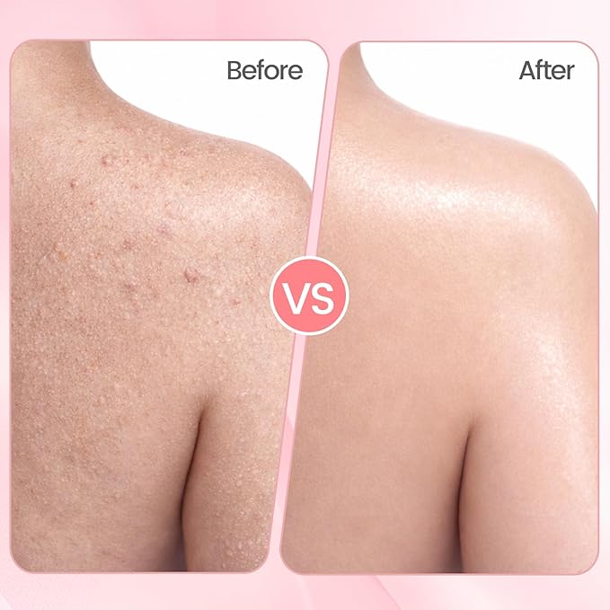 Aromatherapy Body Scrub with Guérande Sea Salt & Coral Rose - Moisturizing Salt Polish for Smooth Skin, Luxurious Bath & Spa Gift Set