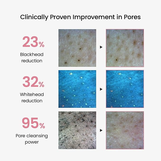 BIODANCE Collagen Cleansing Oil, Facial Oil Cleanser, Gentle Makeup Remover, Removes Bleackhed and Whitehead for Sensitive Skin, Korean Skin Care, Valentines Day Gifts for Herㅣ6.76 fl. oz. (200 ml)