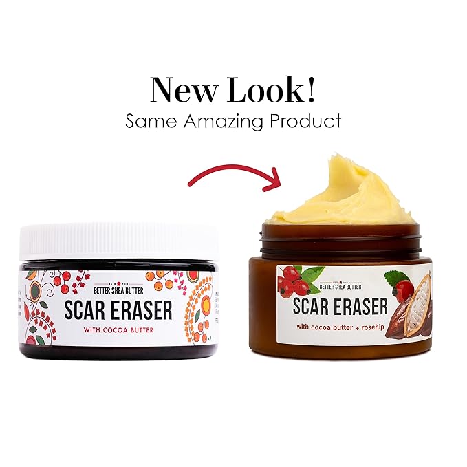 Better Shea Butter Scar Eraser Balm - Cocoa Butter Cream for Stretch Marks and Dark Spots, Burns, Old Scars - Acne Scars - Designed w Zero Synthetic Ingredients, 4 oz