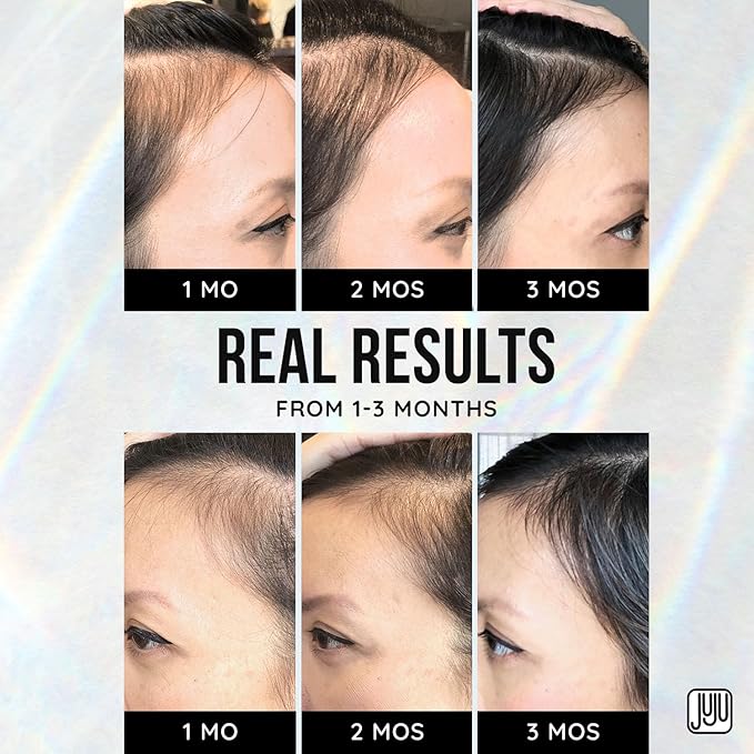 Renovo Biotin Hair Serum Women 1 Fl Oz Fragrance-Free Scalp Nourishing Hairline Enhancer, Hair Thickening Serum for Women, Gentle Formula Biotin Topical Scalp Serums for All Type of Thinning Hairlines