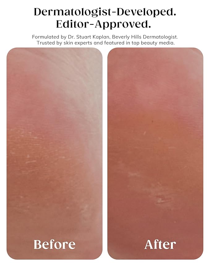 KAPLAN MD Diamond Contour Insta-Glow Gommage Body Peel – Body Exfoliator & Skin Peel with Glycolic Acid, Pineapple Ceramides & Crushed Diamonds - Exfoliating for Smooth, Radiant Skin, 10.14 fl oz