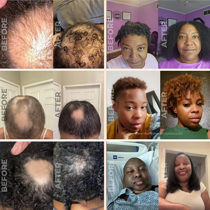 The Mane Attraction Extra Strength Rosemary + Fenugreek Herbal Hair Growth Oil | Infused With Castor Oil for ALL Hair Types