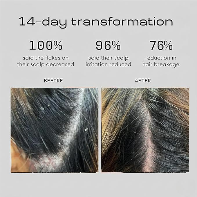 Anti Dandruff Shampoo and Conditioner with 2% Pyrithione Zinc and Stem Cells | Physician Founded for Itchy Scalp | Eliminates Flakes & Fights Dandruff | Color Safe, Sulfate Free, Paraben Free