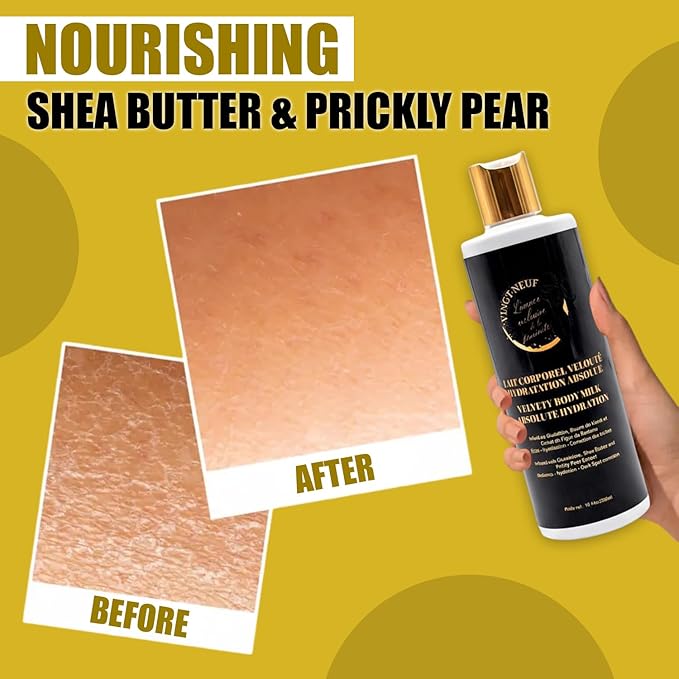 Nourishing Body Lotion for Dry Skin | Shea Butter Body Lotion with Prickly Pear, Niacinamide, Collagen & Hyaluronic Acid | Brightening Body Lotion for Sensitive Skin, 300 ml