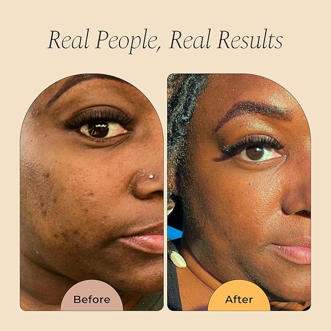 GLO Melanin Turmeric Scrub for Dark Spots, Brightening Inner Thighs Bikini Area Underarms, Natural Exfoliating Face