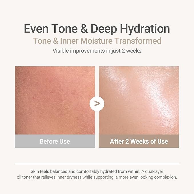 HAYEJIN RiceFila Milk Toner for Glass Skin – 2-in-1 Hydrating Korean Rice Toner with Niacinamide, 8 Hyaluronic Acids & 6 Peptides – Dual Phase Lightweight Rice Bran Facial Toner 5.07 fl oz