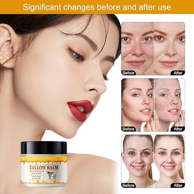 Beef Tallow and Honey Balm for Skin,2 Oz Beef Tallow Balm for Skin Hydration,Grass Fed Beef Tallow Full Body & Face Moisturizer,Tallow Honey Moisturizer,All Natural Body Moisturizing Cream