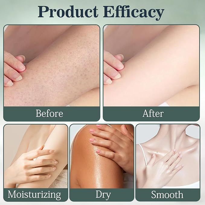 2Pcs Intertrigo Relief Cream, Skin Fold Barrier Cream for Moisture & Friction Protection, Fast-Drying Non-Greasy Formula for Friction-Prone Areas, 2 oz / 57g