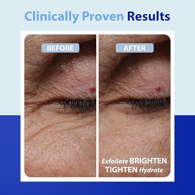 Dr. Denese SkinScience Advanced Firming Facial Pads 100 Count – Professional Exfoliator with Glycolic Acid, Peptides and Aloe for Smooth Radiant Skin, Refined Pores – Dermatologist Tested Cruelty Free