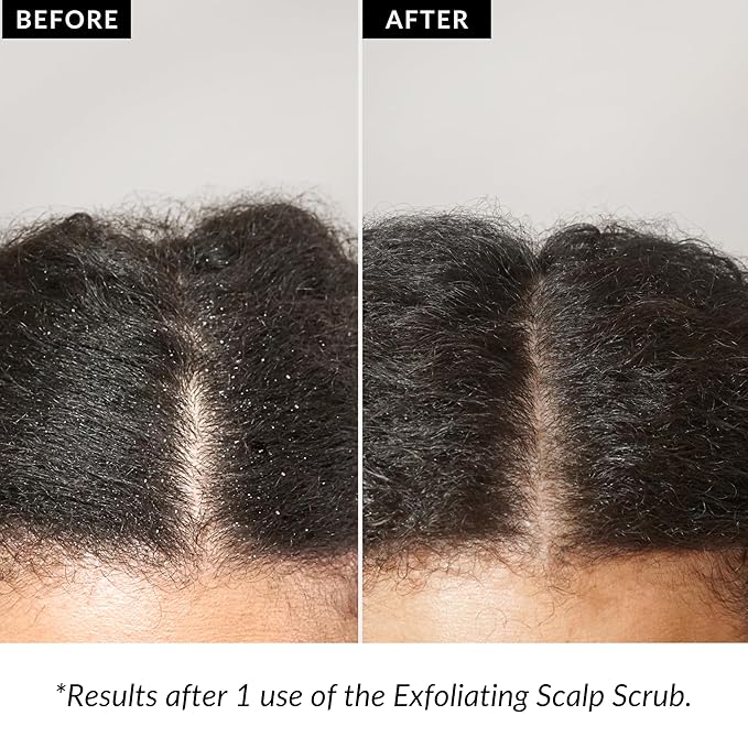 Love Ur Curls Exfoliating Scalp Scrub, Moisturizing, Gentle Build Up Removal for Curly Hair - with Peppermint Oil, for Alll Curl Types, 150mL