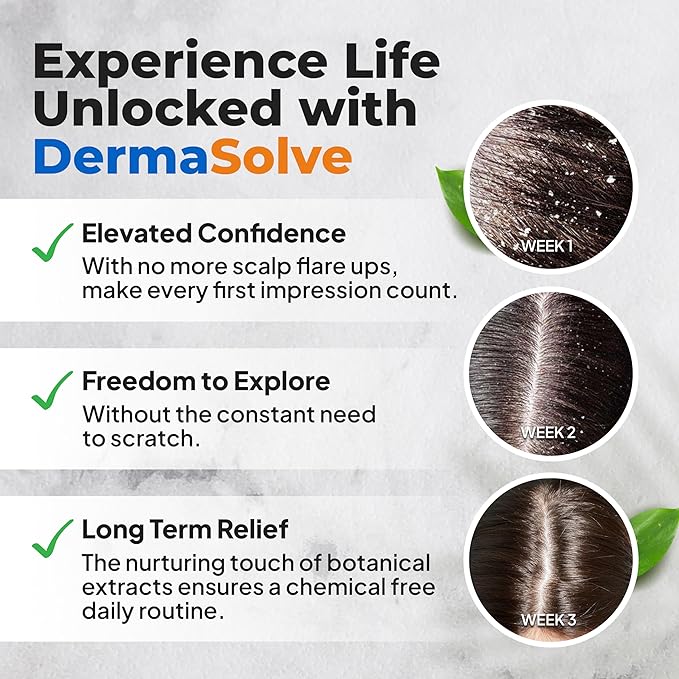 Dermasolve Psoriasis & Dandruff Oil, Dermatologist Approved for Flaky Scalp Relief