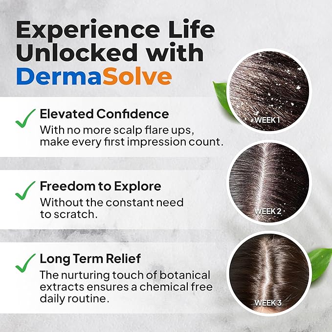 Dermasolve 4 oz Psoriasis, Seborrheic Dermatitis, & Dandruff Scalp Oil - Dermatologist Approved - Flaky Scalp Relief, Clinically Tested, Long-Lasting Itch-Free, High-Performance Formula