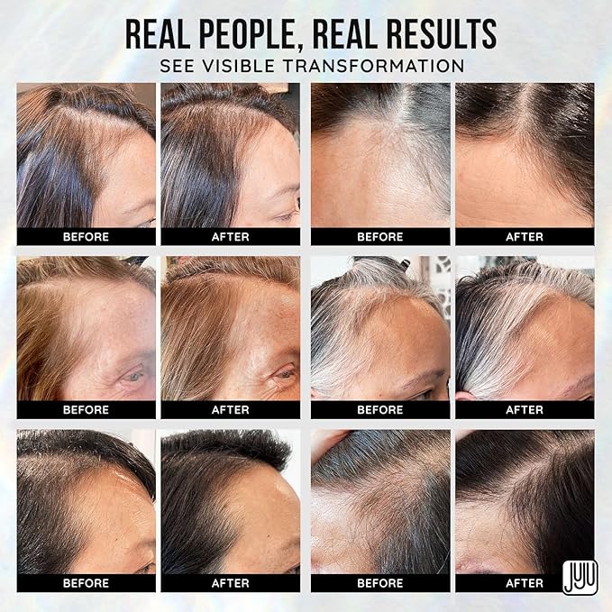 Renovo Biotin Hair Serum Women 1 Fl Oz Fragrance-Free Scalp Nourishing Hairline Enhancer, Hair Thickening Serum for Women, Gentle Formula Biotin Topical Scalp Serums for All Type of Thinning Hairlines