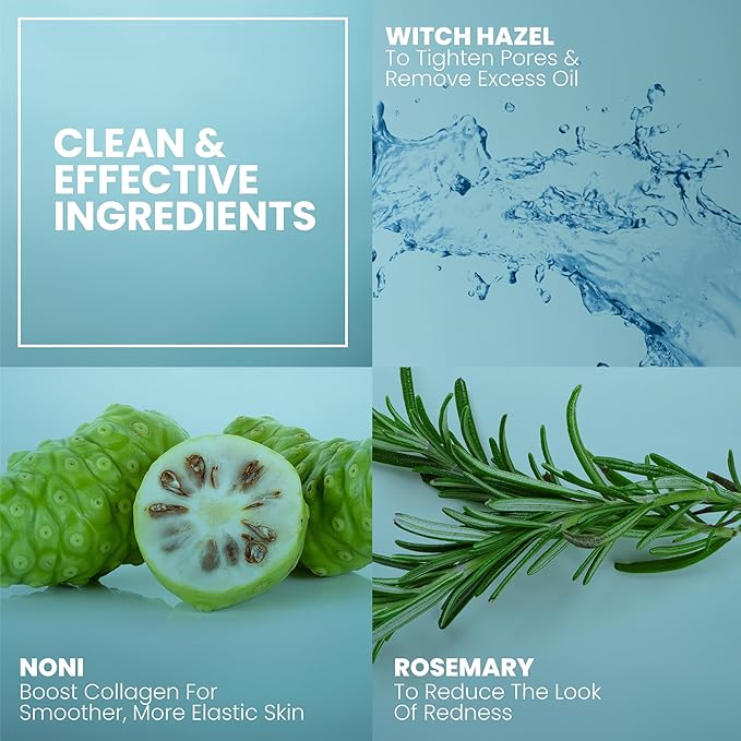 Eva Naturals Witch Hazel Face Toner – Hydrating & Clarifying Toner with Glycolic Acid, Vitamin C & Aloe for Acne, Oily, Dry & Sensitive Skin, Pore Tightening Facial Mist for Balanced Glow (4oz)