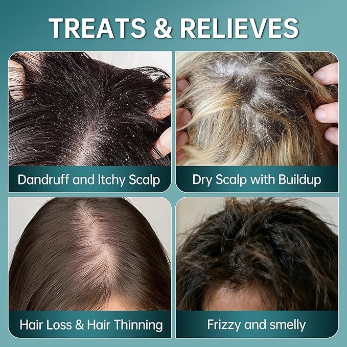 𝐒𝐜𝐚𝐥𝐩 𝐒𝐜𝐫𝐮𝐛 & 𝐒𝐡𝐚𝐦𝐩𝐨𝐨 - Exfoliating Hair & Scalp care | Sea Salt Deep-Cleansing to Remove Build-Up | Anti-Dandruff & Itch Relief for a Balanced Scalp