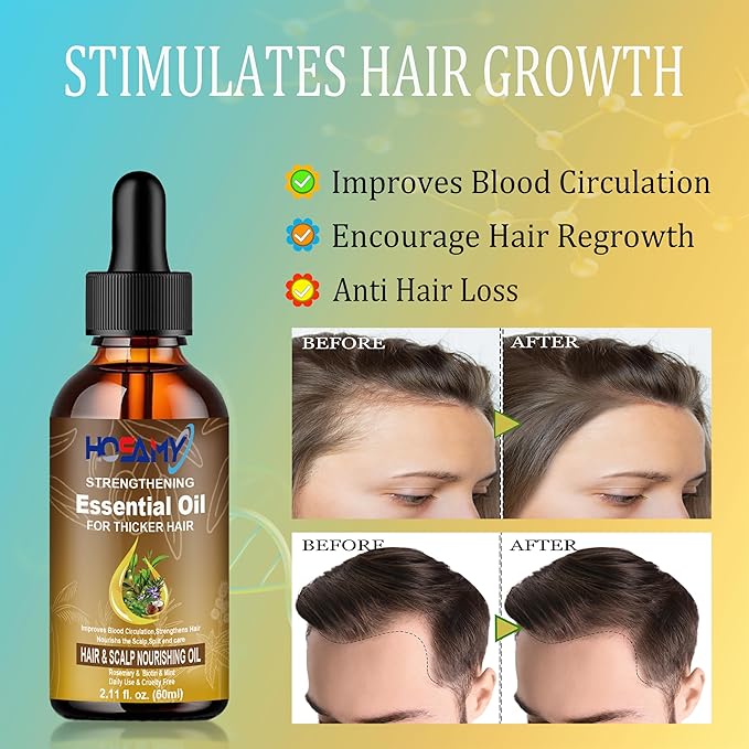 Hair Growth Oil Serum - Lightweight Hair Oil with Biotin,Castor & Rosemary for Thinning Hair - Visibly Thickening Treatment to Reduce Shedding,Hair Frizzy & Nourish Scalp - For Women & Men,60ml