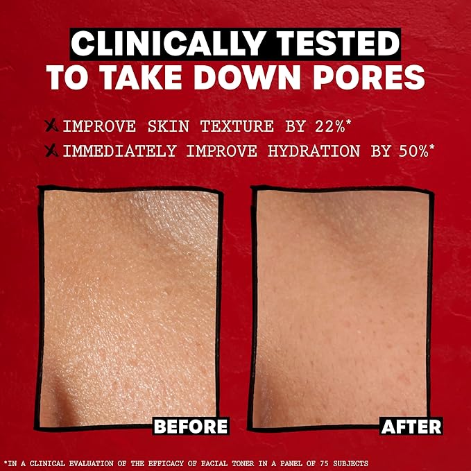 Thayers Trial Size Alcohol Free Unscented Witch Hazel Facial Toner with Aloe Vera Formula- 3 oz