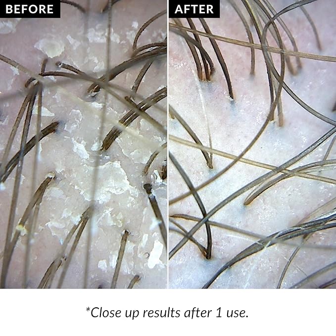 Love Ur Curls Exfoliating Scalp Scrub, Moisturizing, Gentle Build Up Removal for Curly Hair - with Peppermint Oil, for Alll Curl Types, 150mL