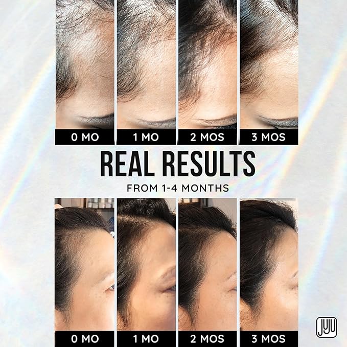 Renovo Biotin Hair Serum Women 1 Fl Oz Fragrance-Free Scalp Nourishing Hairline Enhancer, Hair Thickening Serum for Women, Gentle Formula Biotin Topical Scalp Serums for All Type of Thinning Hairlines