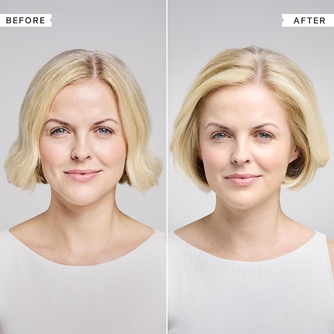 PHILIP KINGSLEY | Density Thickening Protein Spray | Volumizing Spray Treatment for Hair Loss and Fine, Fragile and Damaged Hair | 4.05oz