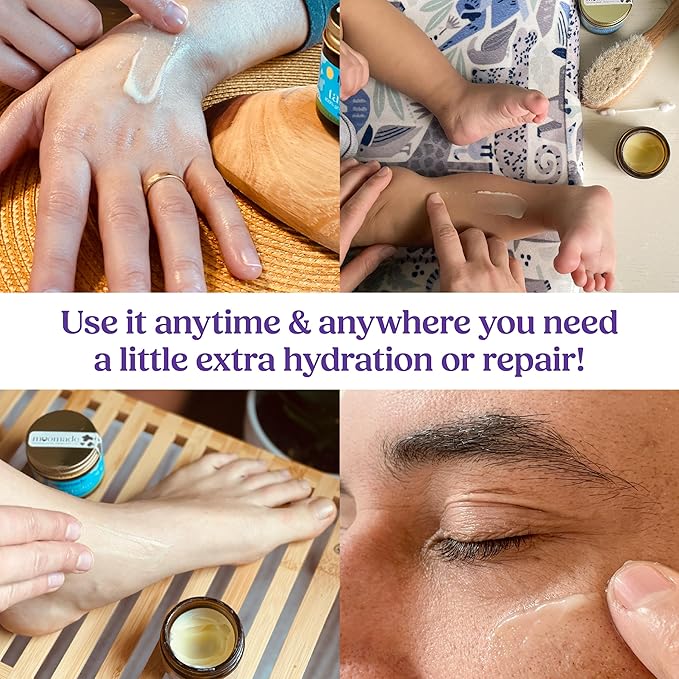 Organic Beef Tallow Balm with Frankincense, Lavender, & Rosehip Oil, 1 oz – Hand Made in USA Tallow Moisturizer for Dry, Sensitive Skin, Rosacea, Eczema | Natural Hydration for Face & Body