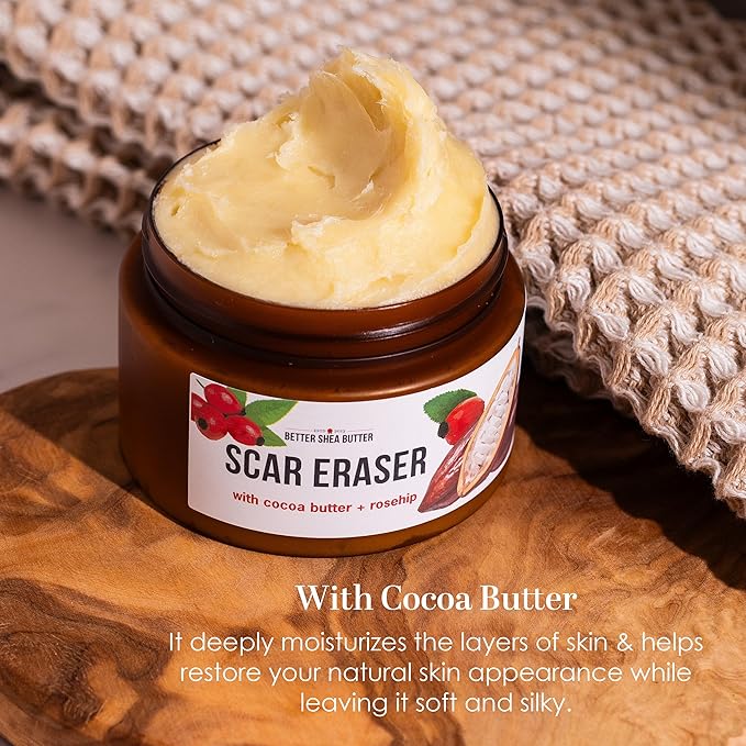 Better Shea Butter Scar Eraser Balm - Cocoa Butter Cream for Stretch Marks and Dark Spots, Burns, Old Scars - Acne Scars - Designed w Zero Synthetic Ingredients, 4 oz