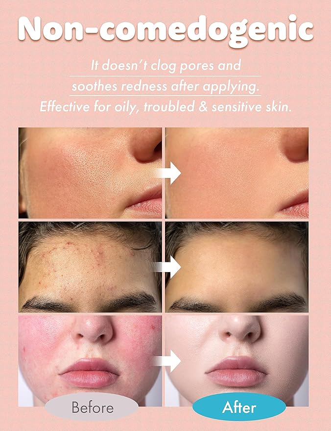 Vertty Tea Tree Vitamin Boosting Coral Toner | Hydrating, Brightening, Moisturizing, Redness Relief Facial Toner | Vitamin B12 Toner | Long-Lasting Hydration | Non-Comedogenic (8.4fl oz)