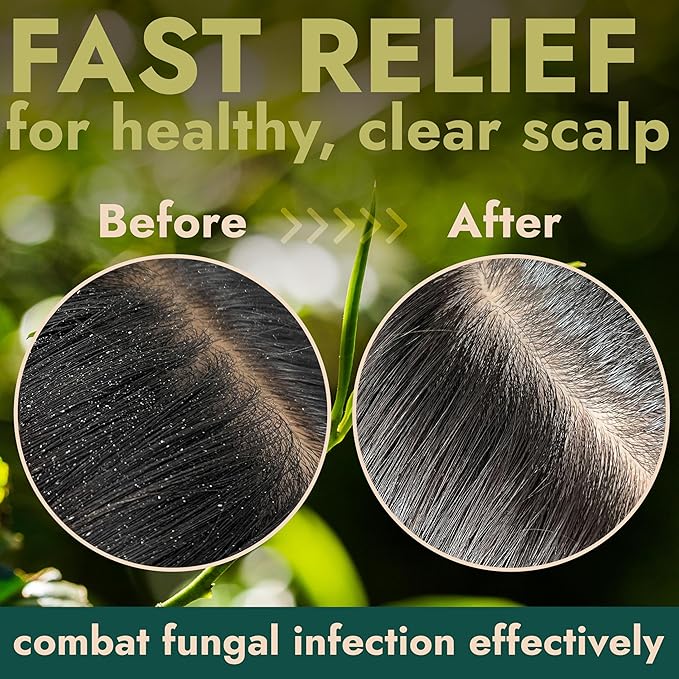 Tea Tree Scalp Scrub | Itchy & Dry Scalp Care with Tea Tree Oil, Quartz Powder & Sea Salt | Gently Exfoliates, Helps Reduce Flakes, Supports Healthy Hair Growth & Scalp Balance