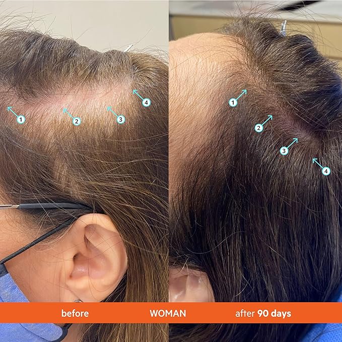 DS Labs Revita Shampoo & Spectral Men’s Serum Kit – Scalp First Cleanse & Lightweight Leave-In for Fuller Looking, Thicker Looking Hair, Sulfate & Silicone Free Shampoo, Fast Absorbing Serum