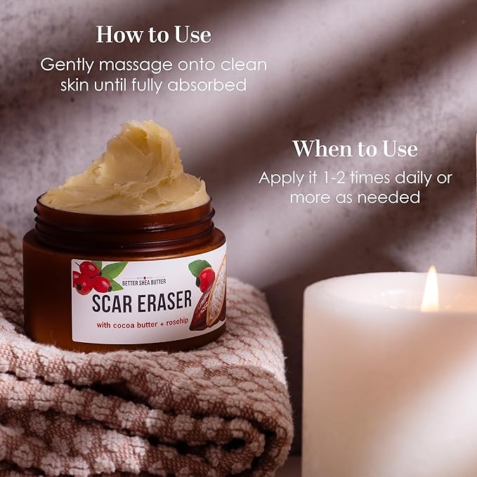 Better Shea Butter Scar Eraser Balm - Cocoa Butter Cream for Stretch Marks and Dark Spots, Burns, Old Scars - Acne Scars - Designed w Zero Synthetic Ingredients, 4 oz