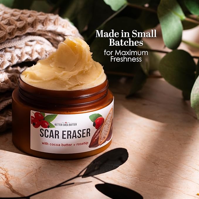 Better Shea Butter Scar Eraser Balm - Cocoa Butter Cream for Stretch Marks and Dark Spots, Burns, Old Scars - Acne Scars - Designed w Zero Synthetic Ingredients, 4 oz
