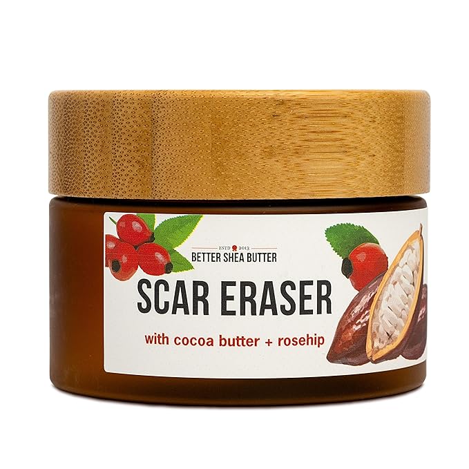 Better Shea Butter Scar Eraser Balm - Cocoa Butter Cream for Stretch Marks and Dark Spots, Burns, Old Scars - Acne Scars - Designed w Zero Synthetic Ingredients, 4 oz