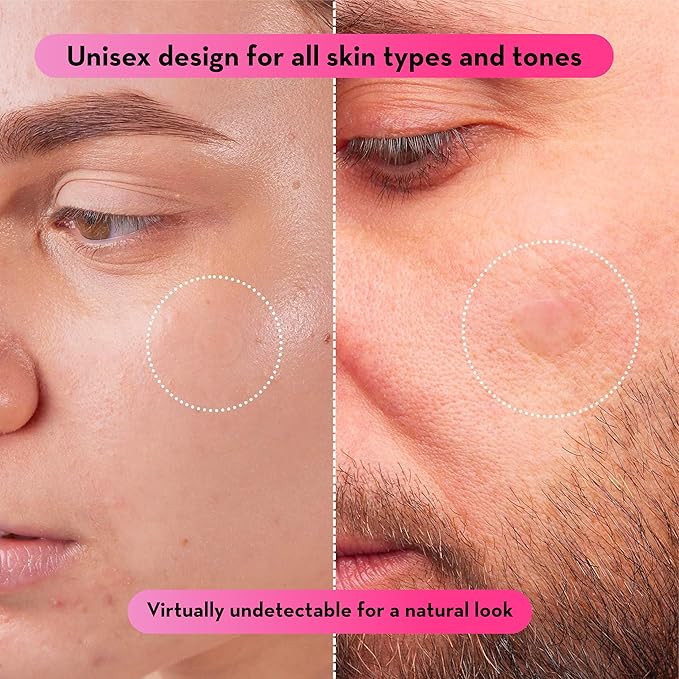 LE GUSHE Pimple Patches for Face (132 Dots) – Hydrocolloid Pimple Patches for Face – Invisible Spot Patches – Hydrocolloid Patch to Help Reduce the Appearance of Spots – Vegan-Friendly